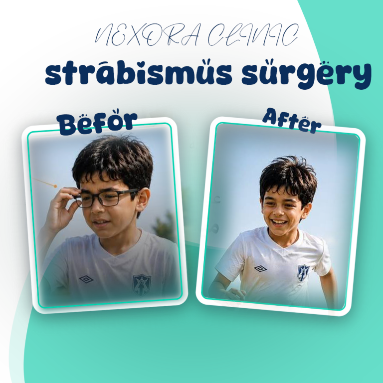 strabismus surgery3